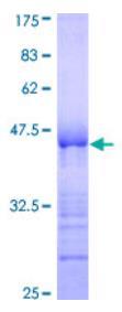 SDS-PAGE (NCAPG-4613H).jpg